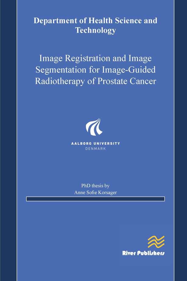 Image Registration and Image Segmentation for Image- Guided Radiotherapy of Prostate Cancer